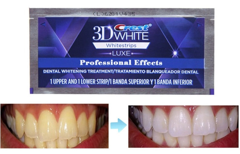 crest 3D White רצועות להלבנת שיניים FACTORYX   